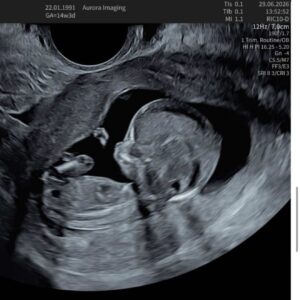 In memory of our little girl